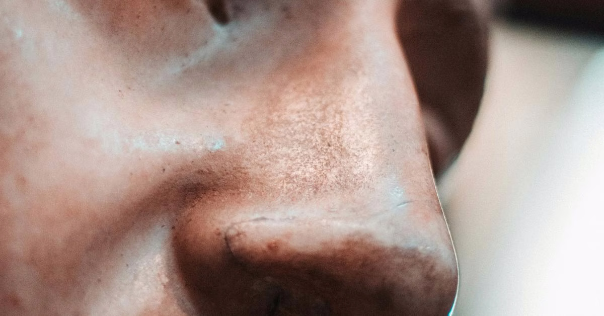 Apa Bedanya Cemas dengan Gangguan Kecemasan?